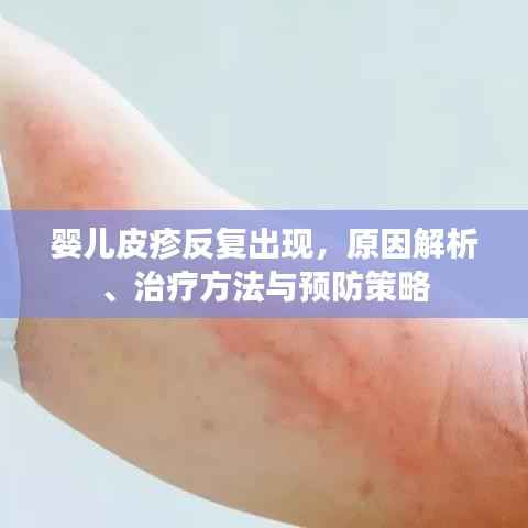 婴儿皮疹反复出现,原因解析、治疗方法与预防策略