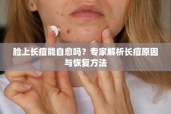 脸上长痘能自愈吗?专家解析长痘原因与恢复方法