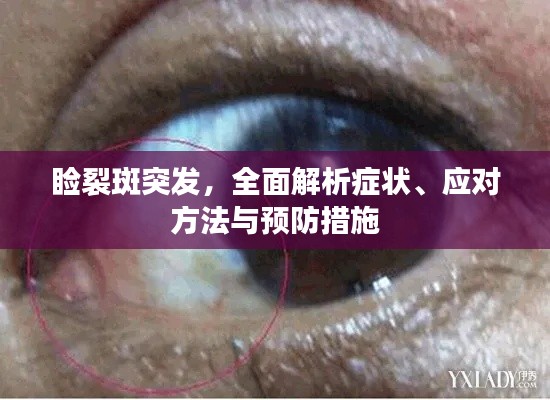 睑裂斑突发,全面解析症状、应对方法与预防措施